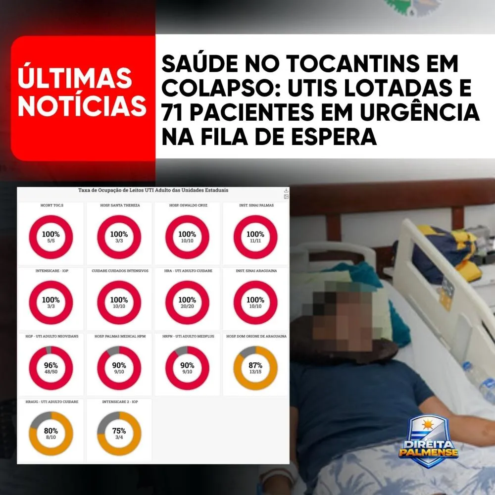 Saúde no Tocantins em Colapso: UTIs Lotadas e 71 Pacientes em Urgência na Fila de Espera